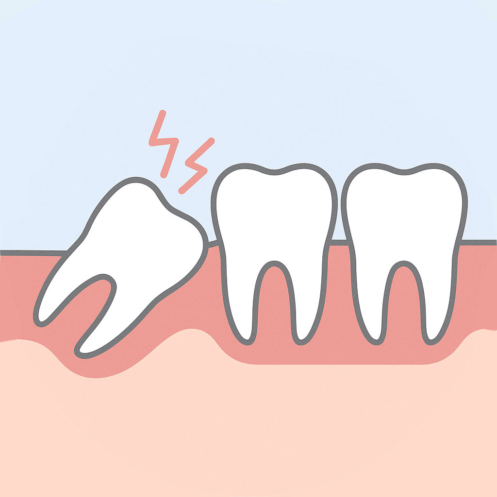 親知らずが痛い